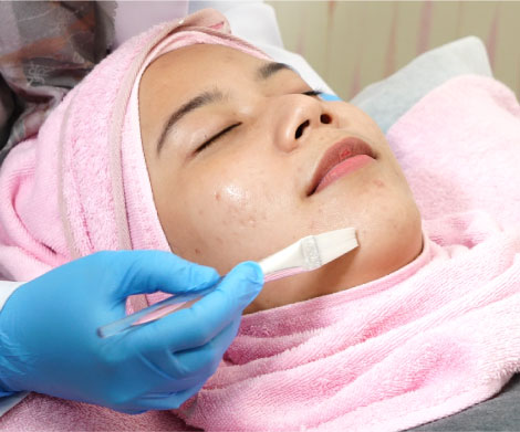 Korean Soft Peel